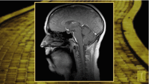 Using a new technique that is 10x faster than average MRI scanners, researchers at the Beckman Institute for Advanced Science and Technology show how the muscles in our neck, jaw, tongue, and lips work together to create sound. This is an MRI of a man singing If I Only Had a Brain from The Wizard of Oz. (Source)