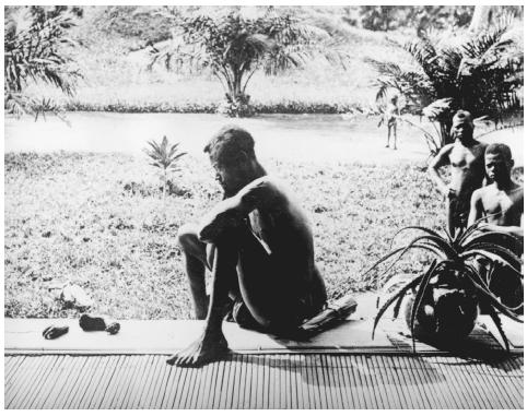 A father stares at the hands of his 5 year old daughter, which were severed as punishment for harvesting too little rubber. This is from when King Leopold ll took control of The Congo during the late 1800&rsquo;s and claimed that he was guiding them towards independence. Instead he implemented extremely harsh policies. 