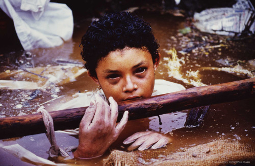 Omayra SanchezOmayra Sanchez was a 13-year-old Colombian girl who became trapped in the debris of her collapsed home, which was caused by a mudslide from the eruption of a volcano in 1985.  Sanchez&rsquo;s legs were bent in a kneeling position and trapped under concrete. Her deceased aunt also had her arms wrapped tightly around the girl&rsquo;s legs.The workers and volunteers realized there was no way to rescue the girl without severing her legs. They lacked the equipment to be able to save her from the effects of amputation, so the doctors decided that it would be more humane to let her die. Sanchez lasted three days before succoming to the likely effects of exposure. The entire world followed her televised plight and was outraged that the government didn&rsquo;t do more to save her and other victims of the mudslide. (Source) 