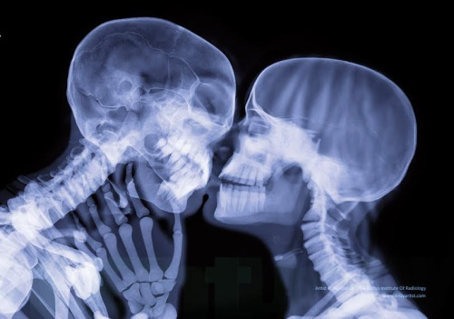 X-Ray of Two People Kissing(Source)