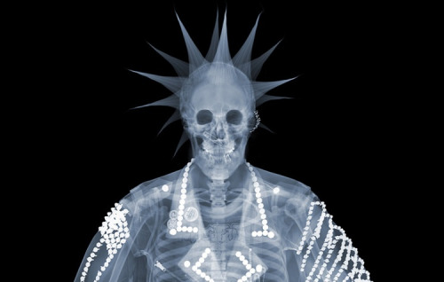 An x-ray of your average Oakland Raiders fan. Source: Nick Veasey