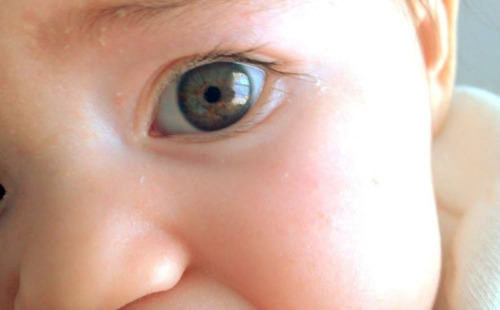 Some babies are often born with blue eyes that get darker over time. Why does this happen? It’s because of melanin. Melanin, produced by cells, is the pigment that’s responsible for giving you the color of your skin and hair. Just as sunlight turns the skin a darker shade, it does the same thing in the iris. When a baby enters the world, melanin production starts in the iris, which can lead to eye color changes. Just a smidgen of melanin and a baby will have blue eyes; add some more and you get green, gray, or hazel; even more and a baby’s eyes will be brown or even black. (Source)