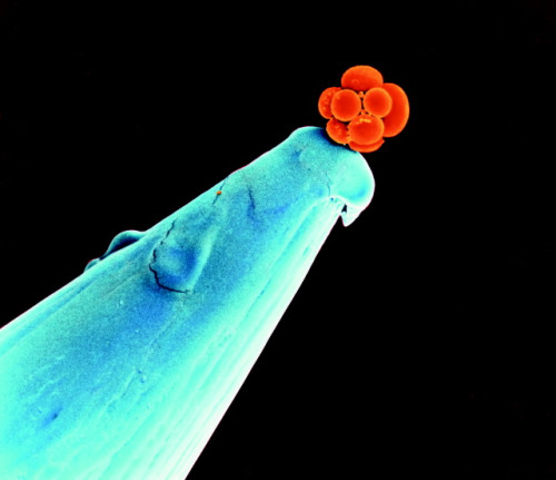 A human morula at the tip of a needle. It&rsquo;s a clump of cells that will eventually turn into an embryo. 