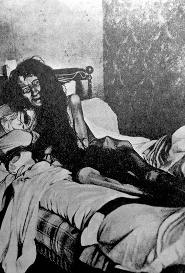 Held Captive for 25 Years by Her Own MotherMademoiselle Blanche Monnier was held captive in a in a padlocked, shuttered room where she was forced to live amidst pests, rats, human excrement, and filth for 25 years by her mother. Her discovery occurred on May 23, 1901 after the Paris Attorney General received an anonymous letter indicating a woman was being held captive in a home located on a “21 rue de la Visitation” street in a wealthy neighborhood of Poiters, France.This is the photo of her the day she was found. You can read more about her story here. 