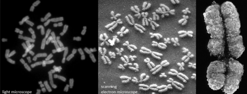 Human chromosomes arrested during cell division. 