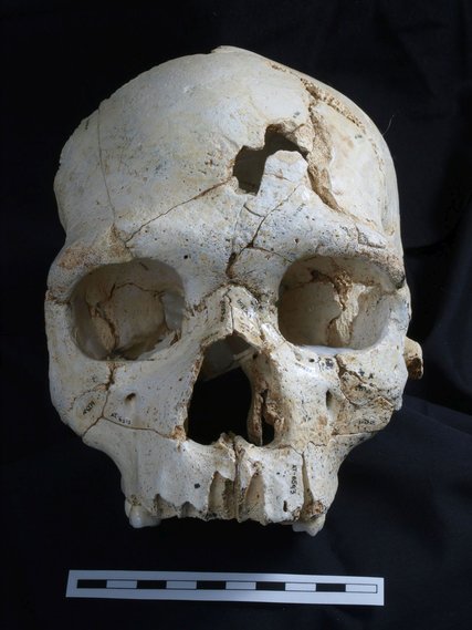 An Early MurderResearchers report that the two penetrating lesions on the skull (430,000 years old, found deep in an underground cave system at Sima de los Huesos) were likely caused by repeated blows from a single instrument. (Source)