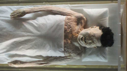  Lady of DaiWhen talking about body preservation and mummies, people all over the world think of Egypt and the mummified bodies of Pharaohs, such as Tutankhamun. But how many know that the world’s best preserved bodies actually come from China?  The Lady of Dai, otherwise known as The Diva Mummy, is a 2,100-year-old mummy from the Western Han Dynasty and the best preserved ancient human ever found. Just how this incredible level of preservation was accomplished has baffled and amazed scientists around the world.(Source)