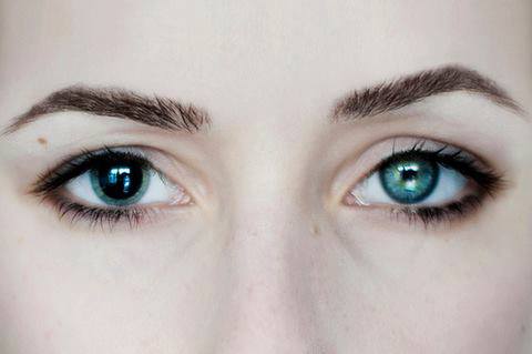 Anisocoria is a condition where the pupil of one eye differs in size from the pupil of the other. Affecting 20% of the population, it can be an entirely harmless condition or a symptom of more serious medical problems.