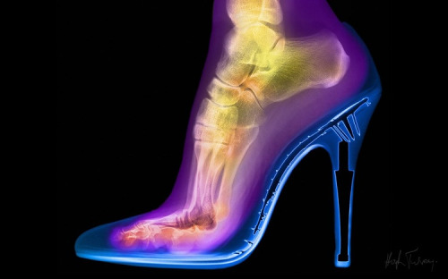 An image of a woman’s foot in a stiletto. (Source)