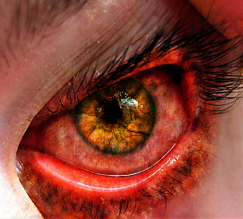 Decisionsby reddit user Francis_GatsbyHe raised his hand up in anger at his youngest son. &ldquo;Damn you to hell,&rdquo; screamed out of his throat. The son stood silently, watching his fathers rage. [[MORE]]He alone had made the decision, the gift to the underling. The food his father had said was off limits to his slaves. He would bear the brunt of his fathers wrath. Every sin he had committed was laid against him, and just as he thought his fathers fury spent, his father cast him out of the family.It was worth it was his musing as he took his walk of shame. Now the slaves had the knowledge that they could defy their master. His father and brothers may hate him but he felt no shame, lucifer never had felt shame.