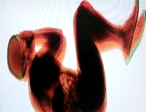 The Norwegian Tourist Who Fell Asleep On An Airport Baggage BeltRome&rsquo;s Fiumicino Airport security procedures were under fire after a drunk Norwegian tourist fell asleep on a baggage belt and travelled 160 feet before being identified by an X-ray scanner. The unnamed 36-year-old arrived at the international terminal of Italy&rsquo;s busiest airport in 2012 with a backpack and a can of beer in his hand. The Norwegian was due to check in for a flight to Oslo. When he found no one on duty at the airline desk, he leapt across the counter and fell into a deep asleep on the baggage belt with his bag beside him. As the belt began to move the unsuspecting tourist reportedly travelled for 15 minutes through the secure baggage area in Terminal 3 before officials spotted his body curled up in a fetal position in an X-ray image on their monitors. He slept through the whole episode and airport police had trouble waking him when they were called to the scene to investigate what had happened. (Source)